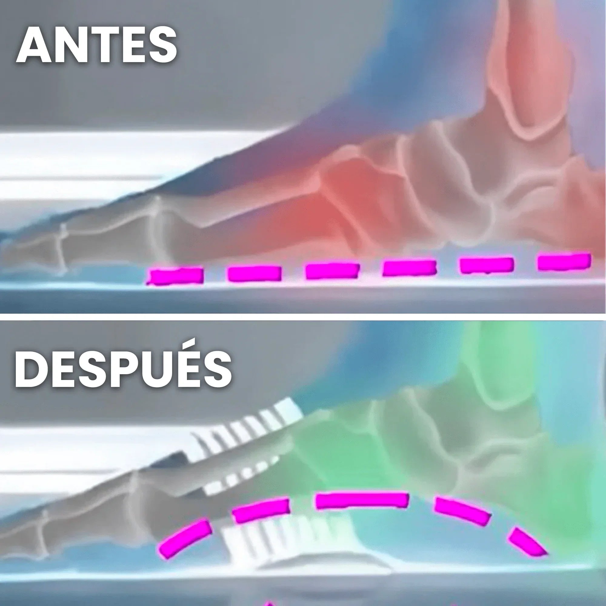 Soporte ortopédico Para el Arco del Pie-OrthoPies™